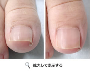 手術前