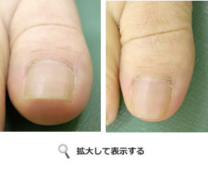 手術後1年9ヶ月